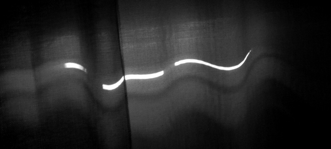 Å ha det kliss mørkt på soverommet kan være bra for hjertet