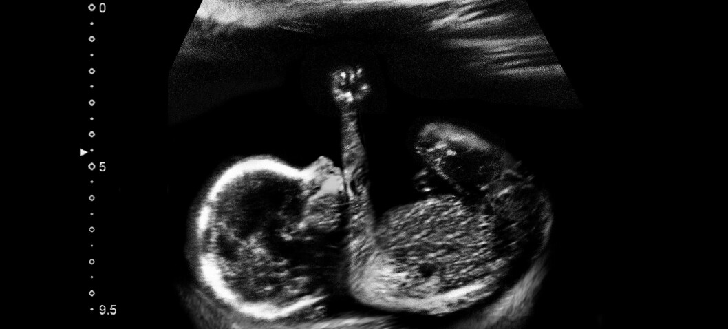 Bibelske proporsjoner