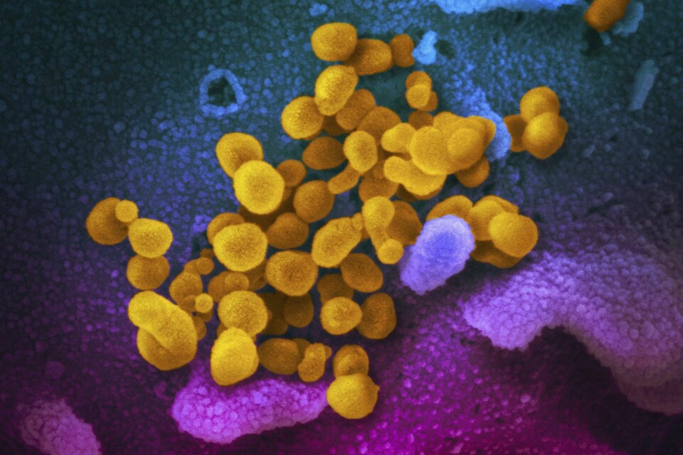 Illustrasjonsfoto. Et bilde av koronavirus tatt med elektronmikroskop. Foto: NIAID-RML / AP / NTB