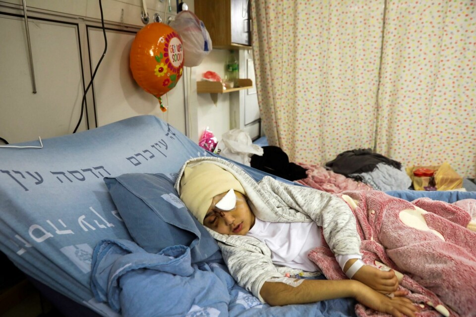 800 palestinske barn er skutt og drept av israelske sikkerhetsstyrker siden 2009, og bruken av skarp ammunisjon mot demonstranter øker. FILE - In this Feb. 20, 2020 file photo, 9-year-old Palestinian boy Malik Eissa rests in Hadassa hospital in Jerusalem. Israeli authorities have cleared police of any wrongdoing in the case of Eissa who lost an eye after apparently being shot in the face by an Israeli officer with what appeared to be a sponge-tipped munition last February. In a statement sent to The Associated Press on Saturday, Dec. 5, 2020, the Israeli Justice Ministry said its unit for internal police investigations concluded that while the incident was sad, there were insufficient grounds for prosecution after interviewing witnesses and reviewing video footage and other evidence. (AP Photo/Mahmoud Illean, File)