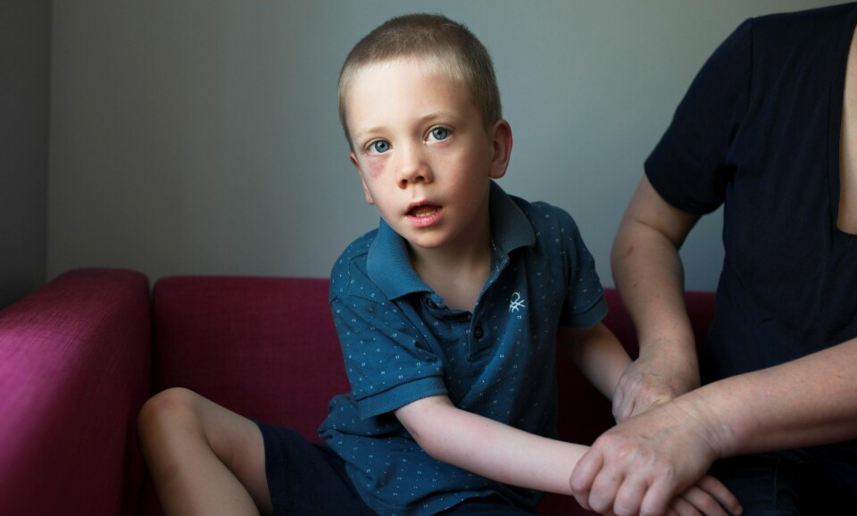 Erik og moren har allerede tilgang på en bil gjennom familien. Hadde de kunnet parkere den på HC-parkeringen i nabolaget hadde livet til de to blitt lettere, mener moren.