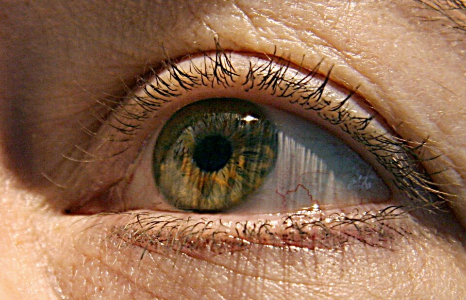 Illustrasjonsbilde: Optogenetisk terapi innebærer at man gjør synsceller i stand til å motta og reagere på lys igjen. (FILES) This file photo taken on April 24, 2007 shows a cloes-up of a woman's eye.An experimental treatment may significantly slow the progression of the blindness-causing disorder macular degeneration, in what would mark the first therapy of its kind, research showed on June 21, 2017. There are currently no available treatments to stymie macular degeneration, the leading cause of blindness in people aged 60 and older. More than five million patients globally are affected by a form of the condition known as geographic atrophy, which causes lesions on the retina. / AFP PHOTO / KAREN BLEIER