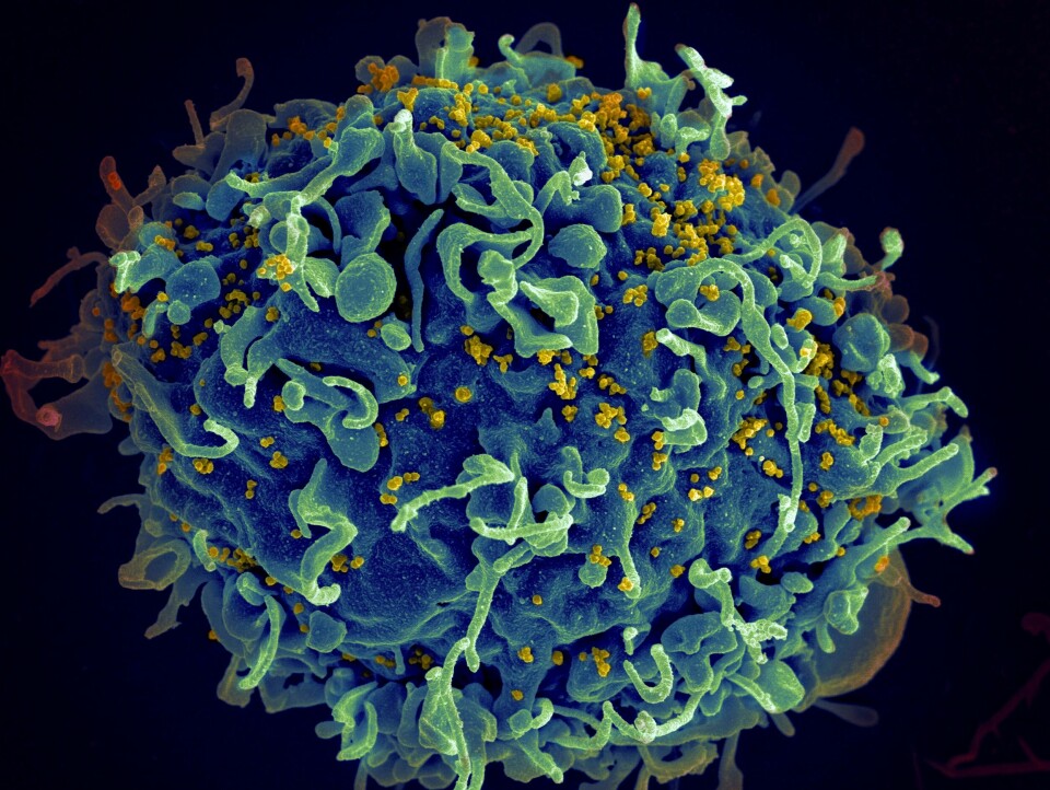 Mikroskop-bildet viser en menneskelig T-celle i blå, som blir angrepet av hiv-viruset i gul. Mikroskop-bildet viser en menneskelig T-celle i blå, som blir angrepet av hiv-viruset i gul. Foto: NIH / AP / NTB
