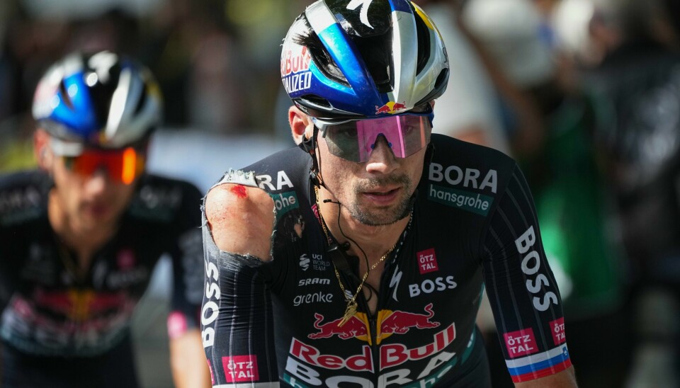 Tour de France-fortsettelsen er usikker for Primoz Roglic etter torsdagens krasj. Tour de France-fortsettelsen er usikker for Primoz Roglic etter torsdagens krasj. Foto: Daniel Cole / AP / NTB