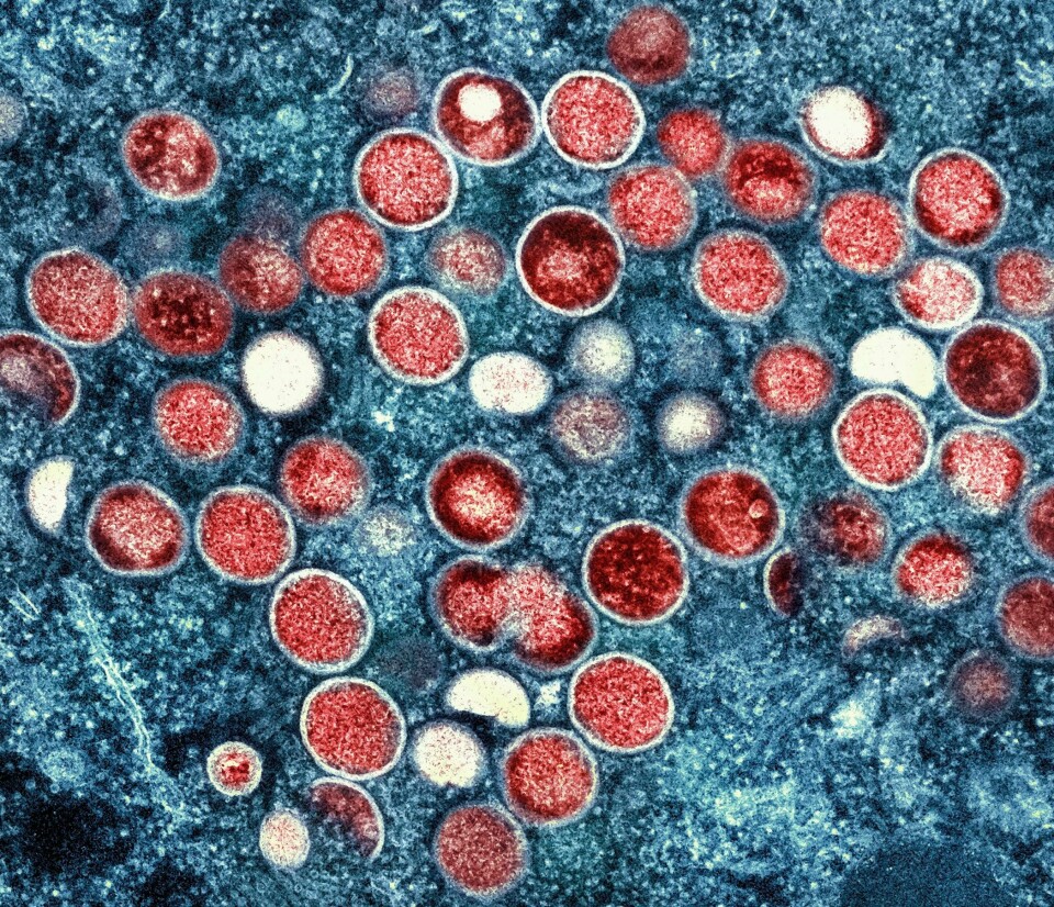 Det europeiske smittevernbyrået ECDC hever risikoen for mpox-smitte i Europa fra lav til moderat. Det er påvist mpox-smitte hos tre personer i Pakistan. Foto: NIAID / AP / NTB