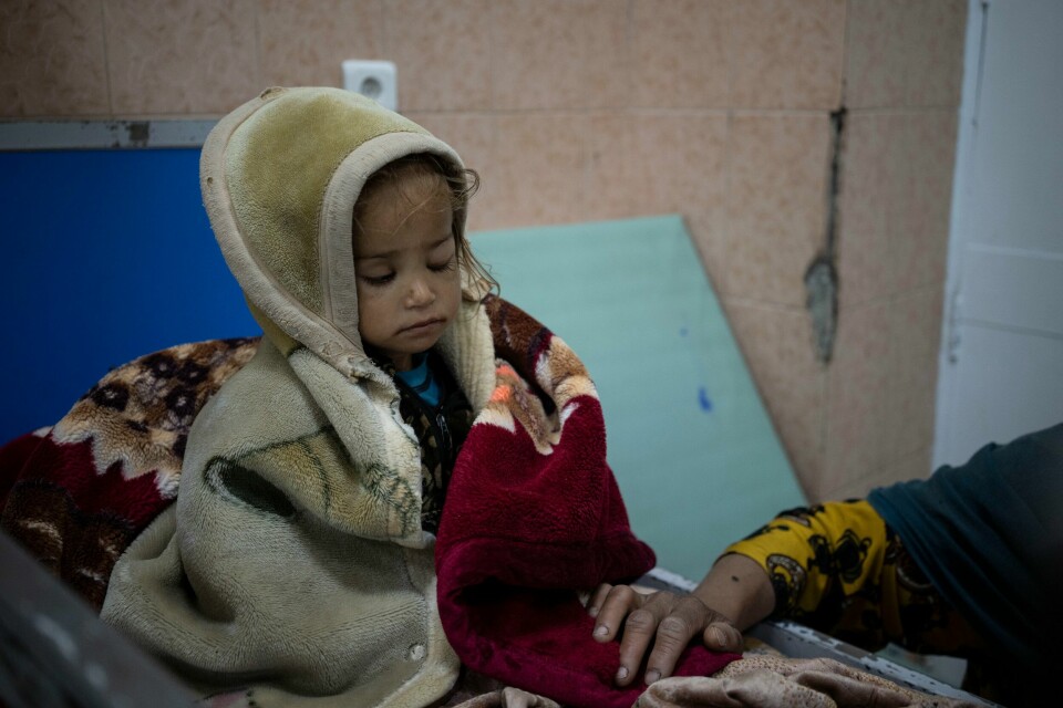 2 år gamle Guldana er feilernært. Her får hun hjelp på Indira Gandhi-hospitalet i Kabul, Afghanistan. Afghanistan Hunger