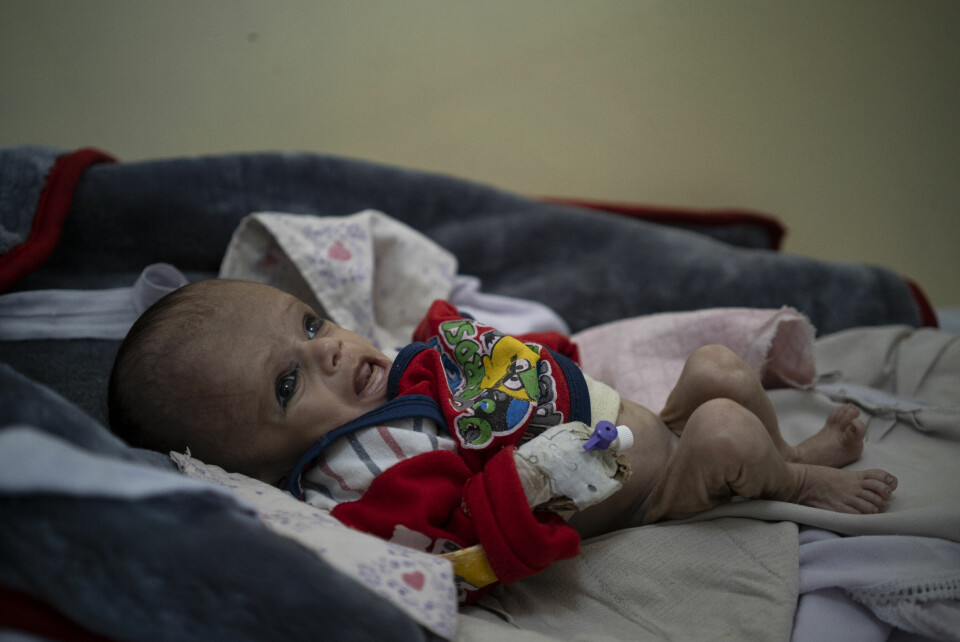 Mohammed, 4 måneder gammel, er underernært og mottar behandling på Indira Gandhi-sykehuset i Kabul, Afghanistan. Ifølge World Food Program, kan 8,7 millioner afghanere rammes av hungersnød denne vinteren. Afghanistan Hunger