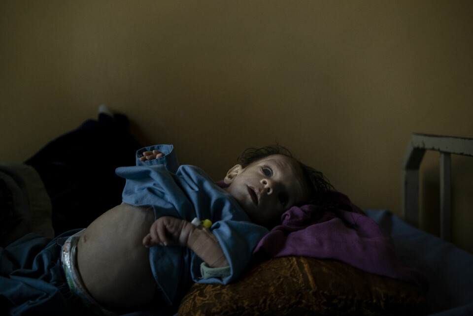 Ett år gamle Mohebullah ble reddet fra å dø av feilernæring i oktober etter å ha fått hjelp på sykehuset i Mirbacha Kot i Afghanistan, til tross for at ansatte i helsetjenesten må jobbe uten lønn og under dårlige forhold. Afghanistan Hospital Taliban Takeover