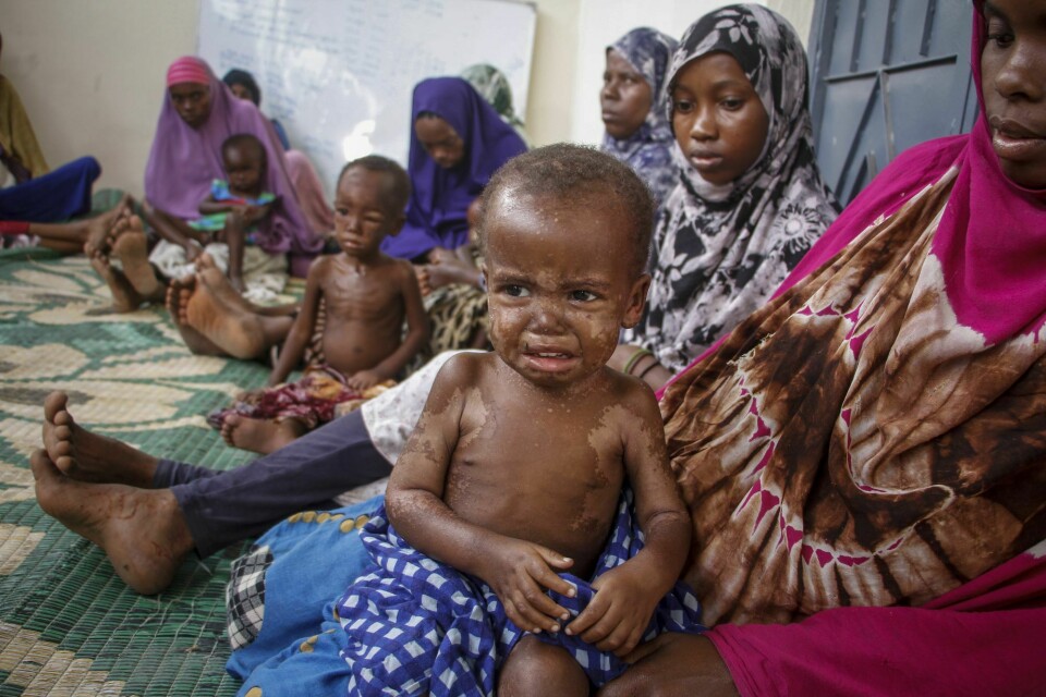 Mange barn lider av feilernæring i Somalia. Disse barna er fordrevet av tørke og har symptomer på kwashiorkor, en mangelsykdom hos småbarn forårsaket av langvarig proteinmangel. De er kommet til et senter i Mogadishu med mødrene sine. Mange barn lider av feilernæring i Somalia. Disse barna er fordrevet av tørke og har symptomer på kwashiorkor, en mangelsykdom hos småbarn forårsaket av langvarig proteinmangel. De er kommet til et senter i Mogadishu med mødrene sine.