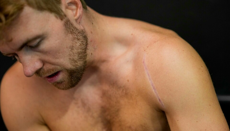 Aleksander Aamodt Kilde var tilbake på ski i juni, men har siden fått flere tilbakefall i opptreningen. Aleksander Aamodt Kilde var tilbake på ski i juni, men har siden fått flere tilbakefall i opptreningen.Foto: Cornelius Poppe / NTB