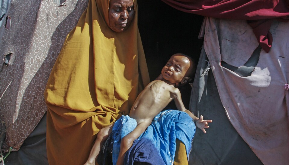 Annethvert barn i Somalia risikerer ifølge Unicef akutt underernæring på grunn av tørken i landet. Tilstanden for det ni måneder gamle barnebarnet til 63 år gamle Boolo Aadan, som lever i en leir for internflyktninger utenfor Mogadishu, er alt kritisk. Annethvert barn i Somalia risikerer ifølge Unicef akutt underernæring på grunn av tørken i landet. Tilstanden for det ni måneder gamle barnebarnet til 63 år gamle Boolo Aadan, som lever i en leir for internflyktninger utenfor Mogadishu, er alt kritisk. Foto: AP / NTB