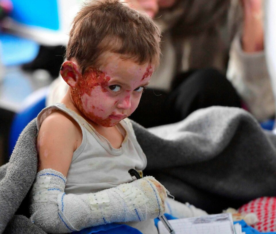 Fem år gamle Mariam er at av de mange barna til jihadistfamilier som nå tas hånd om i Syria. Flere er underernært og skadet med brannsår etter bomber.