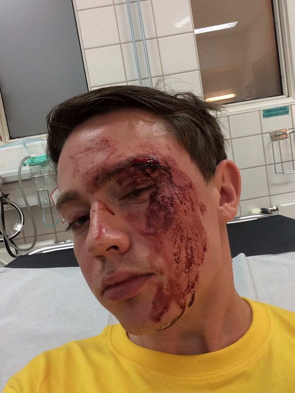 Edvin Eriksen ønsker å vise at vold mot homofile er et problem. Edvin Eriksen ønsker å vise at dette er et problem.