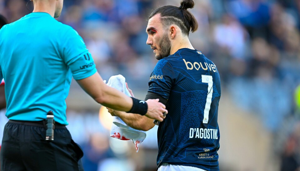 Nicholas D'Agostino scoret Vikings utligning mot Fredrikstad. Her tørker han bort blod etter et kutt over øyet. Nicholas D'Agostino scoret Vikings utligning mot Fredrikstad. Her tørker han bort blod etter et kutt over øyet. Foto: Carina Johansen / NTB