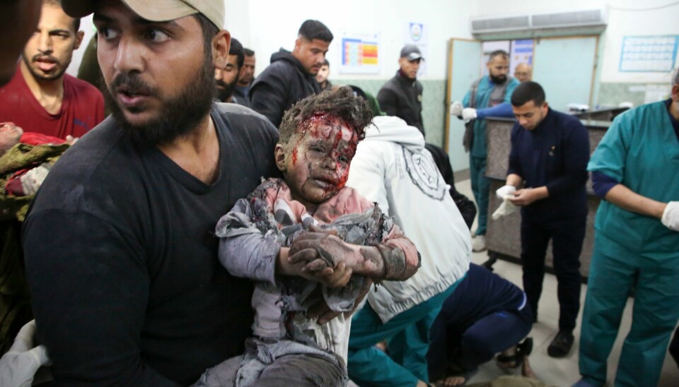 Et palestinsk barn som ble såret i israelske angrep søndag, fotografert på et sykehus i Rafah. Et palestinsk barn som ble såret i israelske angrep søndag, fotografert på et sykehus i Rafah. Foto: Hatem Ali / AP / NTB