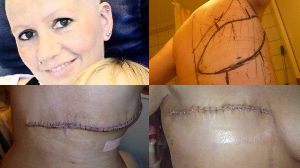 Bilder fra perioden da Aud Karin Grønvold gjennomgikk brystkreftbehandlingen. Hun omtaler perioden som brutal. Bilder fra perioden da Aud Karin Grønvold gjennomgikk brystkreftbehandlingen. Hun omtaler perioden som brutal.