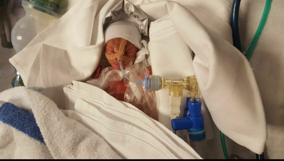 Det aller første bildet av Chris Michael, tatt rett etter fødselen. Vekt 514 gram, og 27 centimeter lang. Det aller første bildet av Chris Michael, tatt rett etter fødselen. Vekt 514 gram, og 27 centimeter lang.