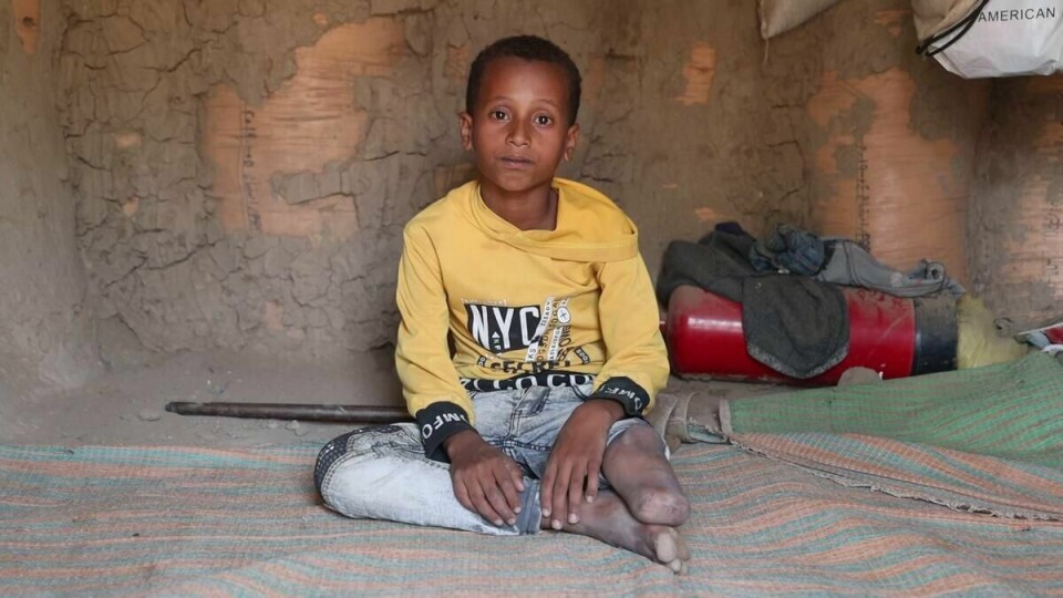 Ni år gamle Zaid bor med familien sin i en leir for fordrevne i Taiz, Jemen. For fem år siden mistet han beinet i et granatangrep. Ni år gamle Zaid bor med familien sin i en leir for fordrevne i Taiz, Jemen. For fem år siden mistet han beinet i et granatangrep.