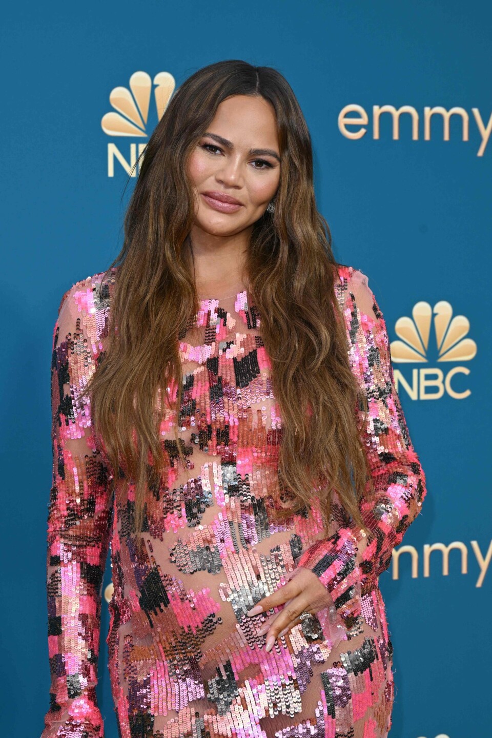 La ut instastory om buccalfettsuging: Chrissy Teigen under utdelingen av Emmy Awards i september i fjor. Chrissy Teigen under utdelingen av Emmy Awards i september i fjor.