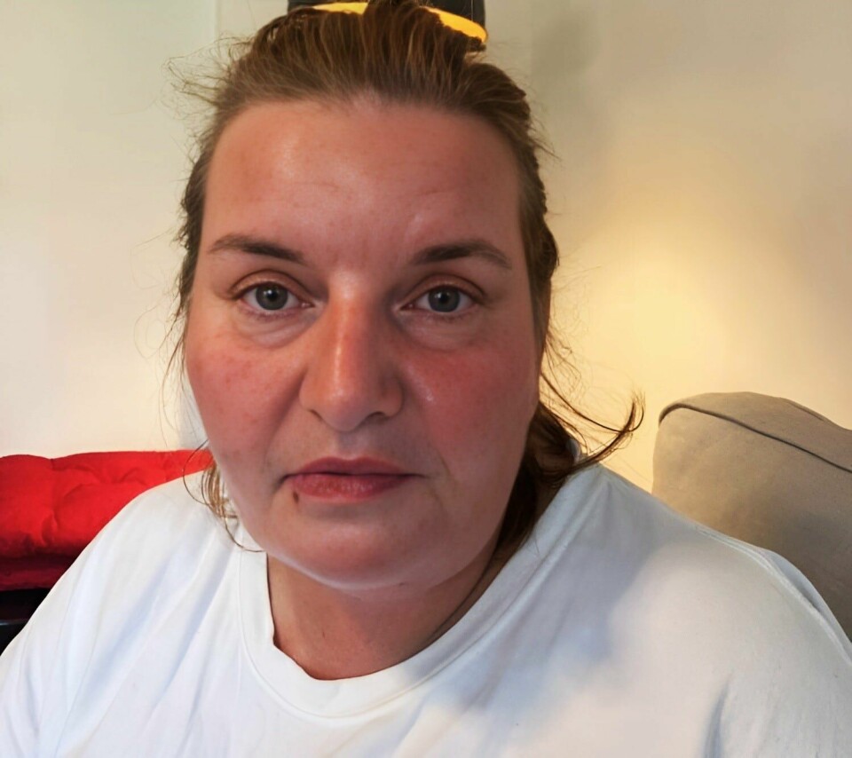 – Prøver å være tapper og ta en time av gangen, sa Anniken Nordengen på dag seks etter det omfattende inngrepet i over- og underkjeven. – Prøver å være tapper og ta en time av gangen, sa Anniken Nordengen på dag seks etter det omfattende inngrepet i over- og underkjeven.