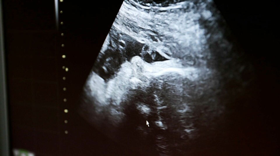 Illustrasjonsbilde. Oslo 20180528.
Høygravid kvinne. Foster på ultralyd.
Foto: Lise Åserud / NTB scanpix