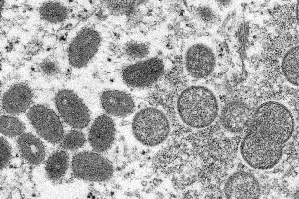 Illustrasjonsfoto: Apekopper i mokroskop FILE - This 2003 electron microscope image made available by the U.S. Centers for Disease Control and Prevention shows mature, oval-shaped monkeypox virions, left, and spherical immature virions, right, obtained from a sample of human skin associated with the 2003 prairie dog outbreak. Two children have been diagnosed with monkeypox in the United States: a toddler in California and an infant who is not a U.S. resident, health officials said Friday, July 22, 2022. (Cynthia S. Goldsmith, Russell Regner/CDC via AP, File)