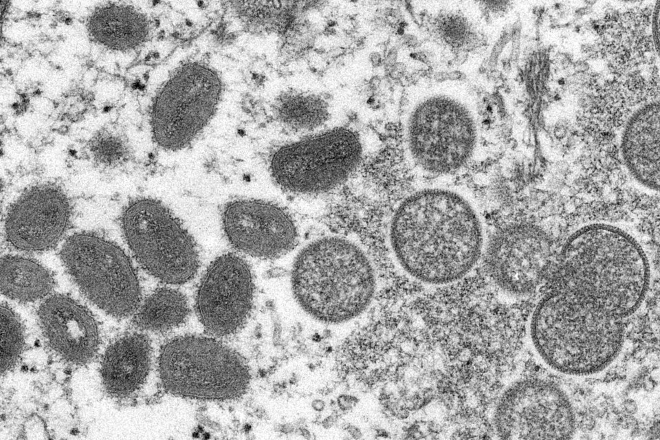 Det er nå registrert over 50.000 tilfeller av virussykdommen apekopper i verden, ifølge Verdens helseorganisasjon (WHO). Apekopper smitter ved nær fysisk kontakt. Foto: Cynthia S. Goldsmith, Russell Regner/AP/NTB