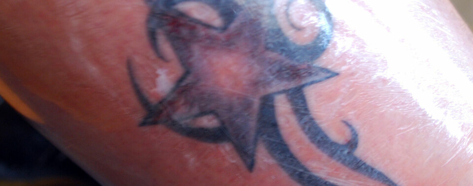 Tatovering med plast over. Tatovering med plast over.