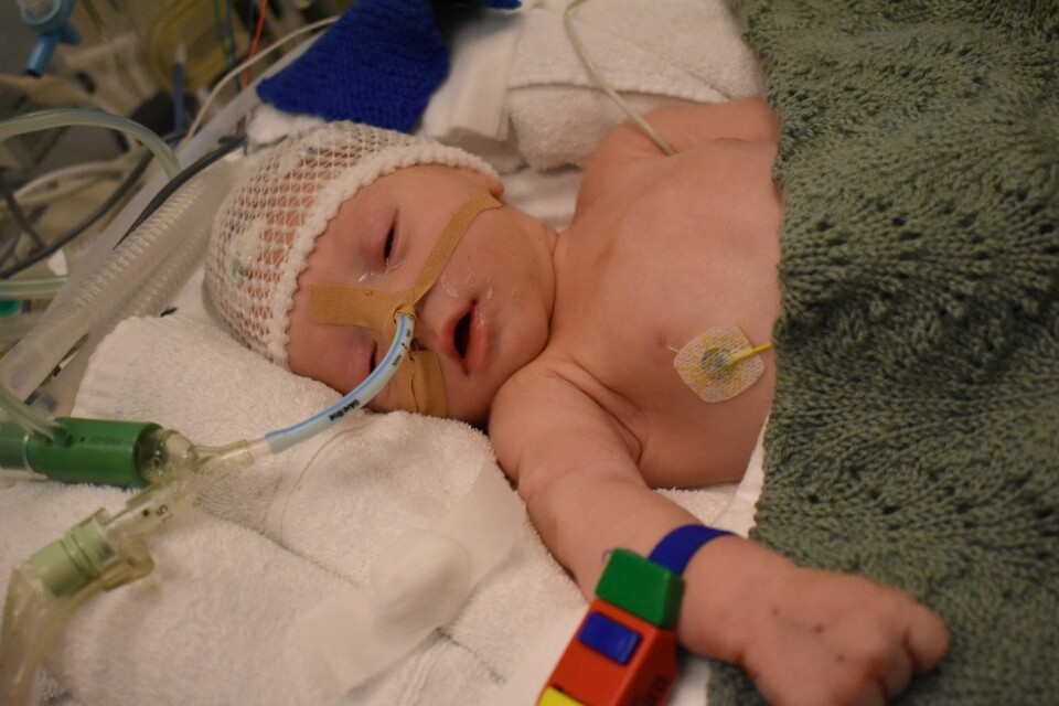 Miran Lucas koblet til respirator og fått på EEG for måling av hjerneaktivitet på neonatal avd på Ålesund Sykehus. Miran Lucas koblet til respirator og fått på EEG for måling av hjerneaktivitet på neonatal avd på Ålesund Sykehus.