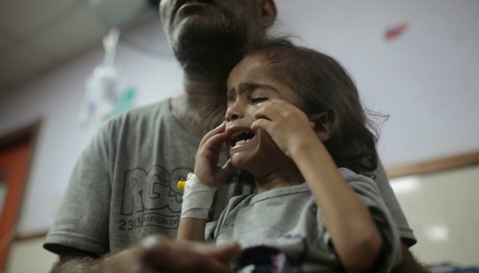 Ni av ti palestinske barn på Gazastripen får for lite mat til å kunne vokse seg sunne og sterke, ifølge FNs barnefond (Unicef). Abdulrahman Al-Rai med den tre år gamle datteren Hana. Den lille jenta lider av diabetes og er kraftig underernært. Foto: AP / NTB