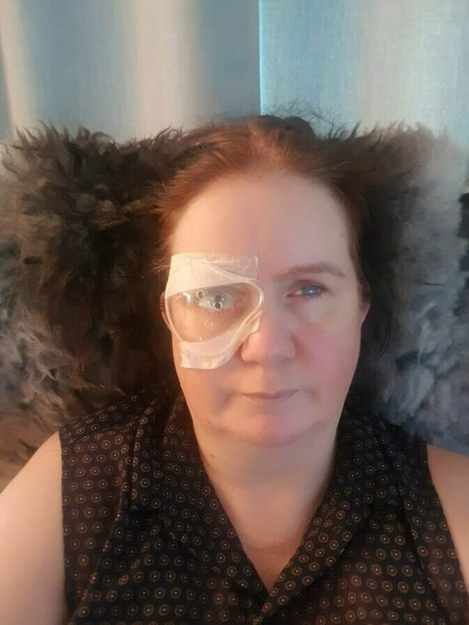 Marit Langøy har Sticklers syndrom Her etter 9. øyeoperasjon, grå stær (i full narkose) og innleggelse i september 2019. Marit Langøy, Sticklers syndrom, 9. Øyeoperasjon, grå stær (i full narkose) og innleggelse Hode- hals klinikken Haukeland Universitetssykehus, september 2019,