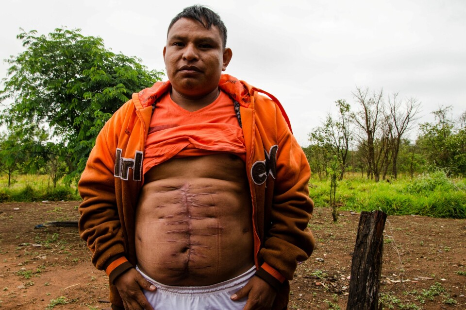 Læreren Jesus de Souza kom fra angrepet på urfolksokkupasjonen med livet i behold. Det gjorde ikke broren hans Clodiode. Etter tre uker på sykehus forbereder han seg på å vende tilbake til jobben som lærer i urfolksreservatet Caarapó. Læreren Jesus de Souza kom fra angrepet på urfolksokkupasjonen med livet i behold. Det gjorde ikke broren hans Clodiode. Etter tre uker på sykehus forbereder han seg på å vende tilbake til jobben som lærer i urfolksreservatet Caarapó.